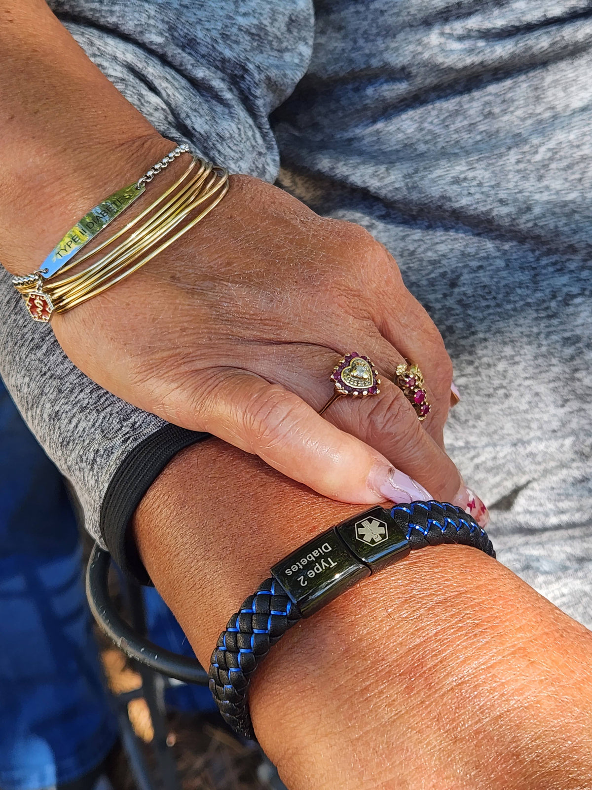Why get a medical alert bracelet?